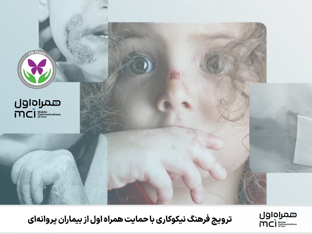 ترویج فرهنگ نیکوکاری با حمایت همراه اول از بیماران پروانهای ترویج فرهنگ نیکوکاری با حمایت همراه اول از بیماران پروانهای