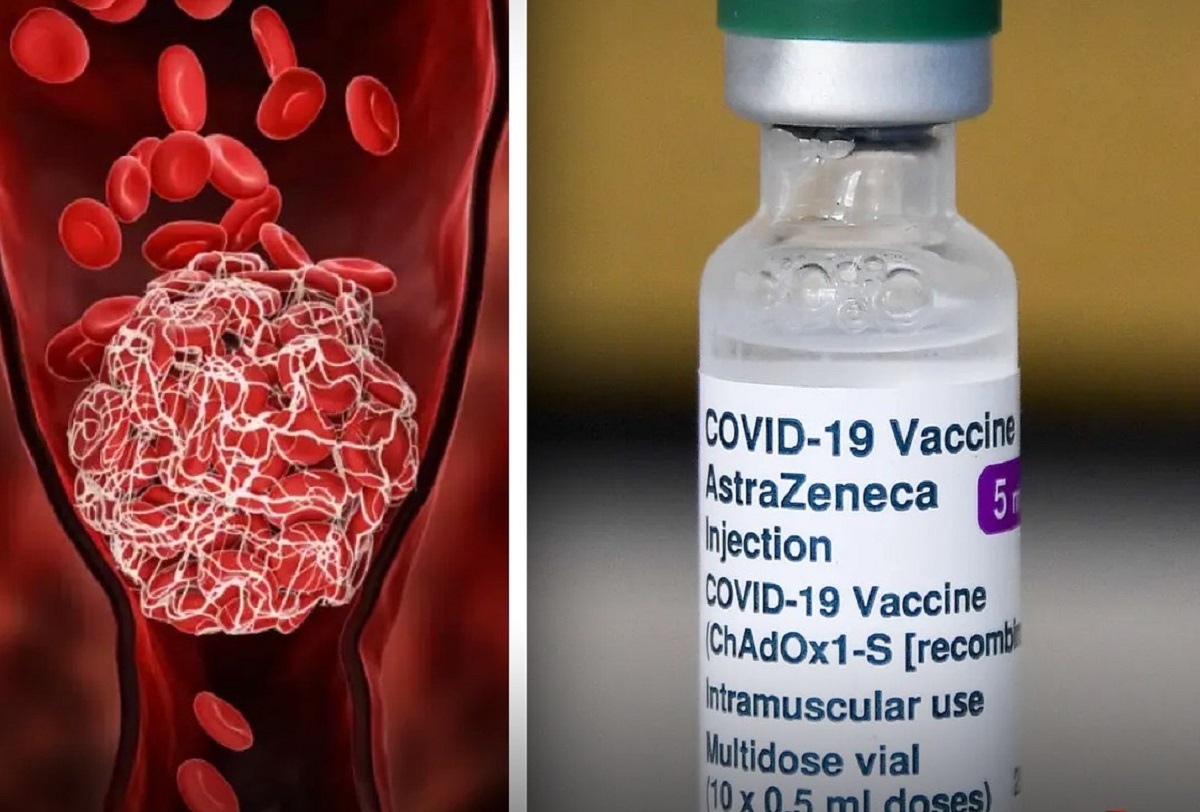 آسترازنیکا آسترازنیکا