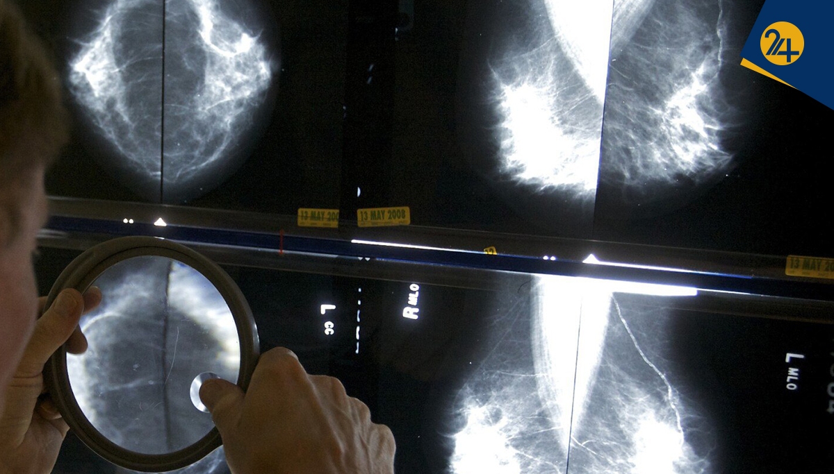 سن غربالگری سرطان سینه ۴۰ سال می‌شود