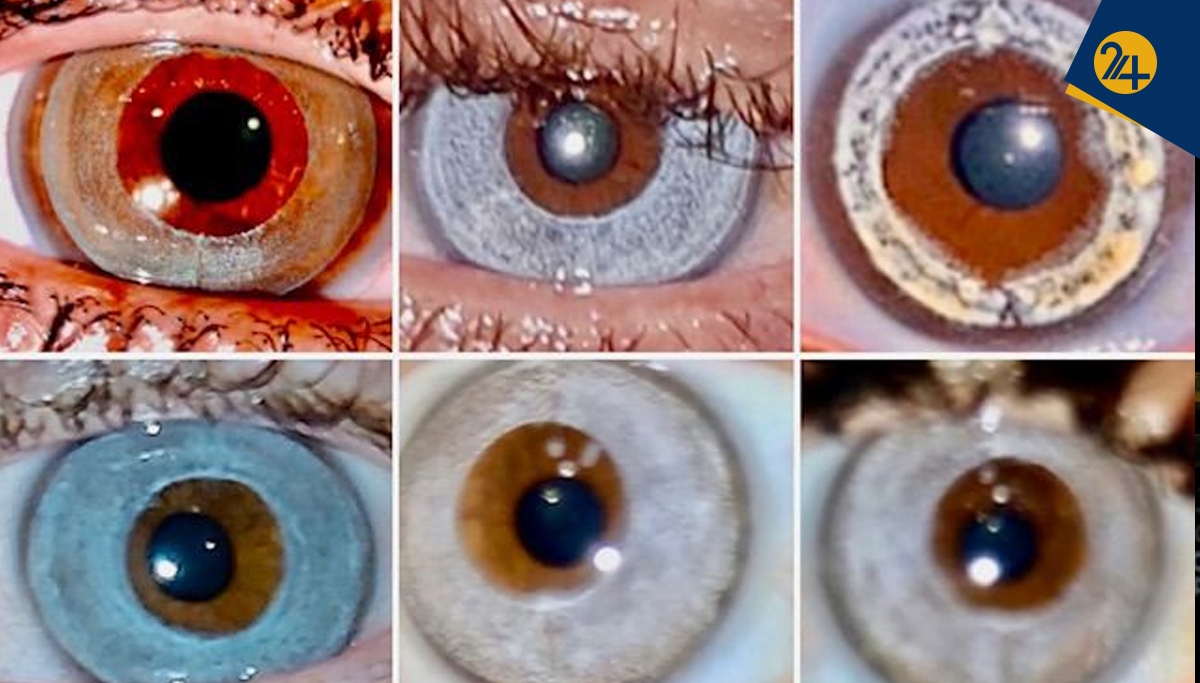 همه آنچه باید درباره بازار جدید تغییر رنگ چشم باید بدانید همه آنچه باید درباره بازار جدید تغییر رنگ چشم باید بدانید