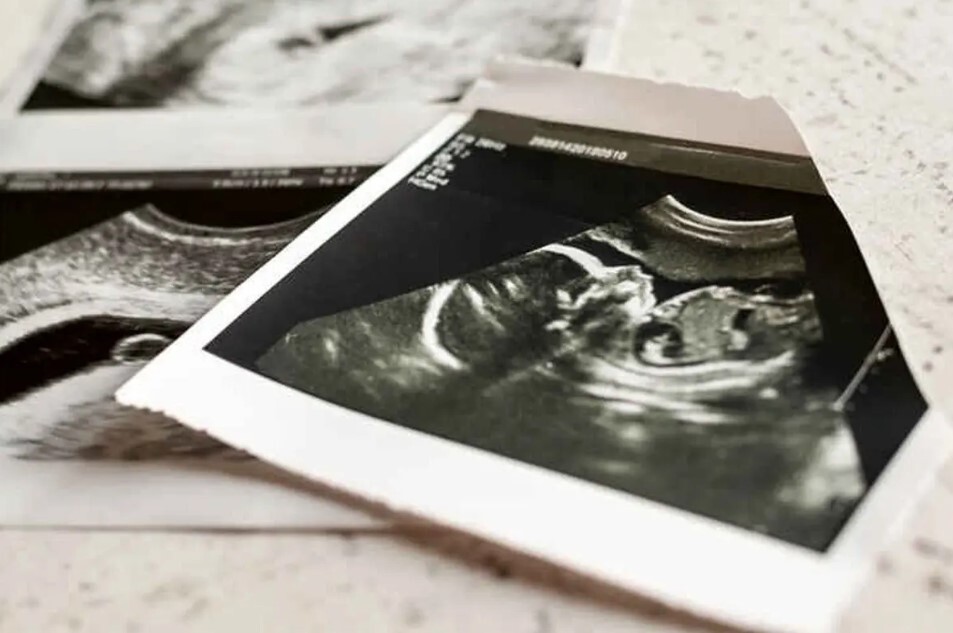 مبالغ نجومی برای سقط جنین غیرقانونی؛ از ۷۰ تا ۱۵۰ میلیون! مبالغ نجومی برای سقط جنین غیرقانونی؛ از ۷۰ تا ۱۵۰ میلیون!