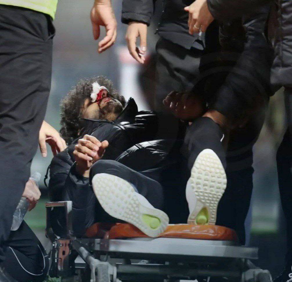 ببینید| لحظه عجیب مصدومیت بازیکن مس توسط هم تیمی اش! ببینید| لحظه عجیب مصدومیت بازیکن مس توسط هم تیمی اش!