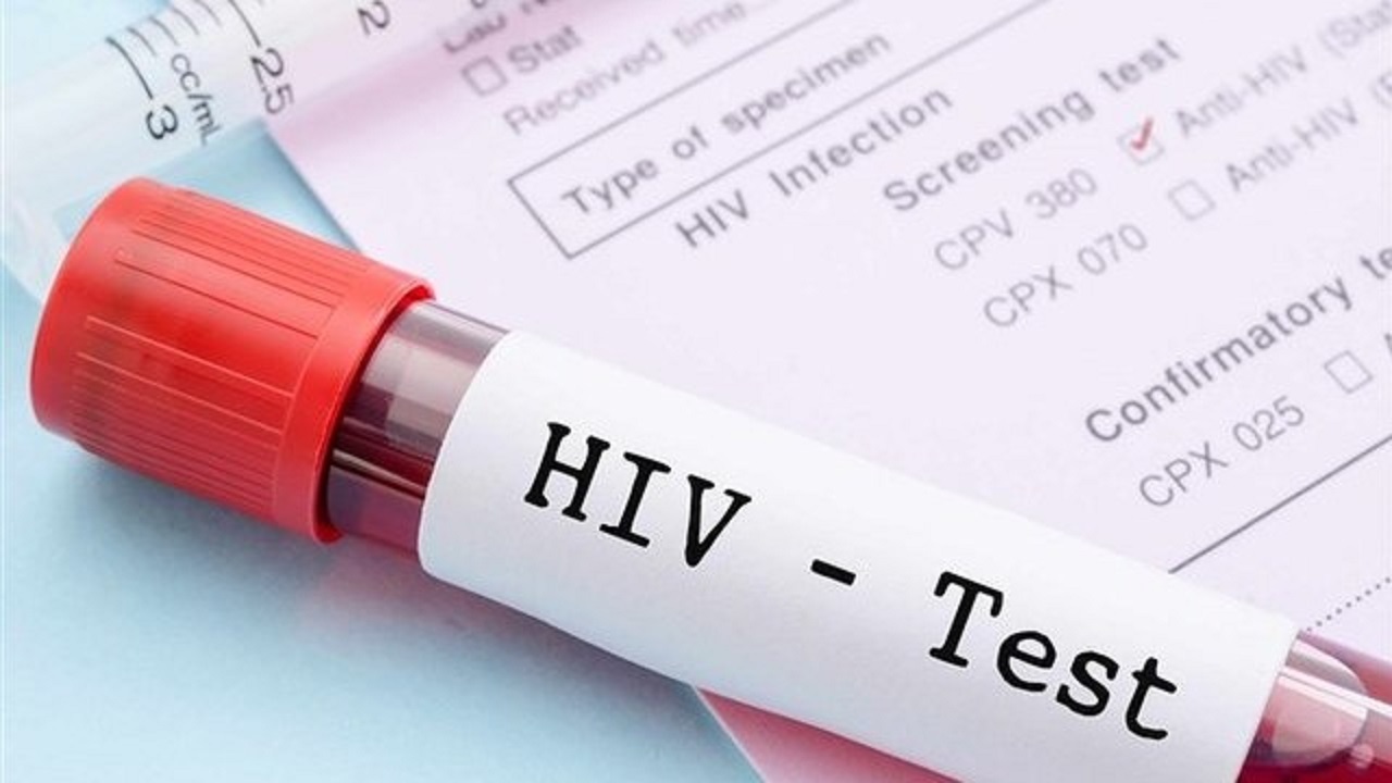 آمار نگران کننده مبتلایان به HIV در ایران آمار نگران کننده مبتلایان به HIV در ایران