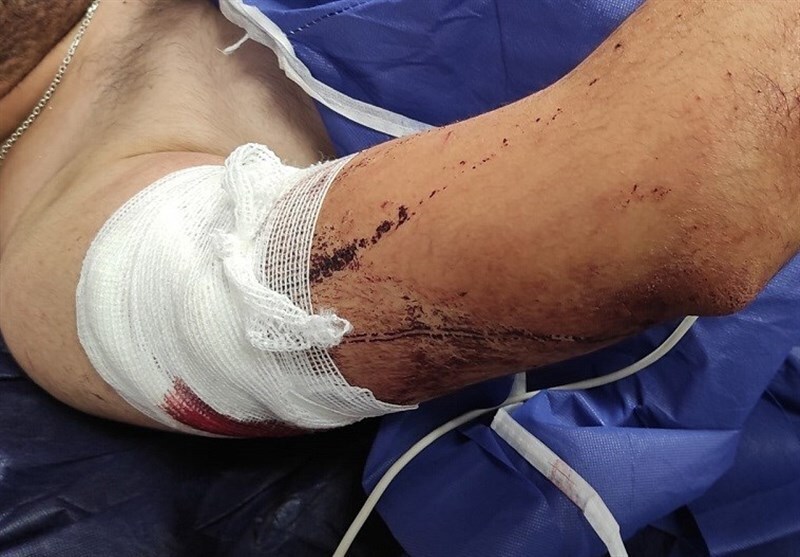 حمله هولناک خفت‌گیرها به یک جوان | یک دانشجوی دیگر قربانی شد