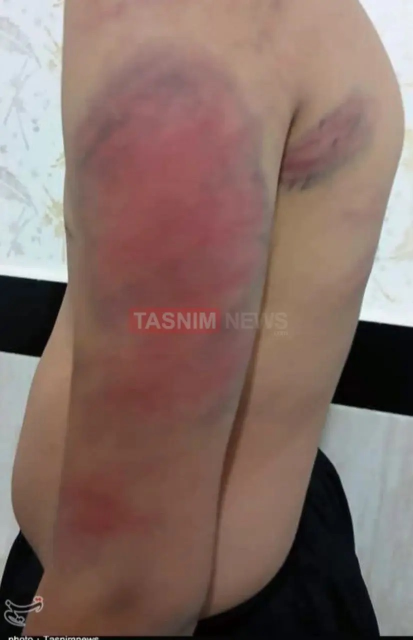 شکنجه دانش‌آموزان دبستانی توسط معلم به علت گم شدن شارژ موبایل! +عکس