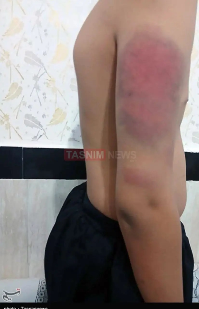 شکنجه دانش‌آموزان دبستانی توسط معلم به علت گم شدن شارژ موبایل! +عکس