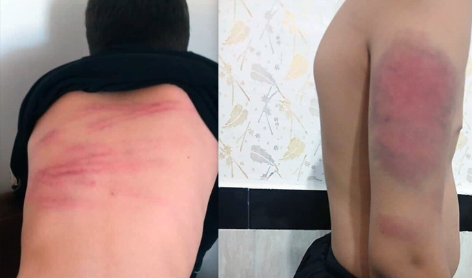 جزئیات ماجرای شکنجه دانشآموزان با کابل توسط معلم | حال خوشی نداشتم! جزئیات ماجرای شکنجه دانشآموزان با کابل توسط معلم | حال خوشی نداشتم!