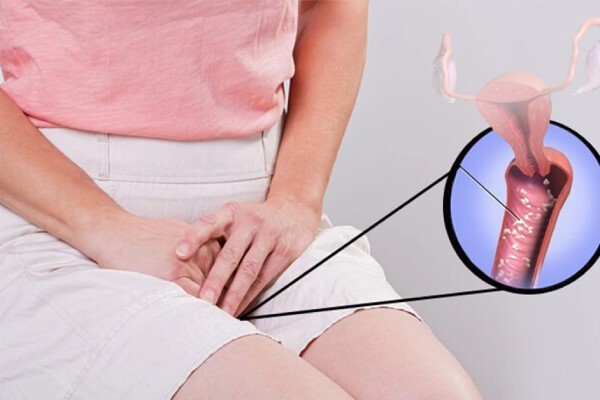 علت سوزش ادرار در زنان چیست؟ درمان سریع سوزش ادرار در زنان علت سوزش ادرار در زنان چیست؟ درمان سریع سوزش ادرار در زنان