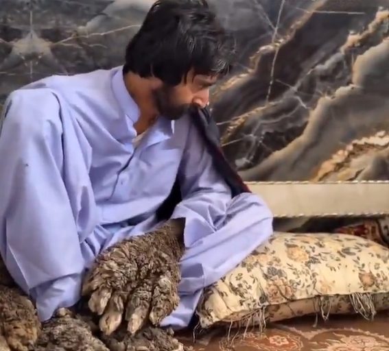 ببینید| دستانی که به درخت تبدیل شدند، اما هنوز امید به کمک دارند