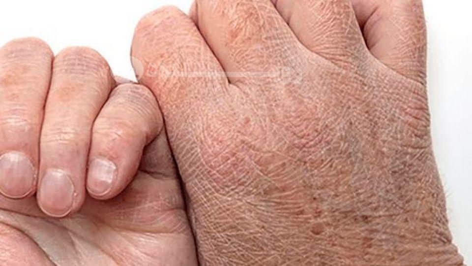 تاثیر خشکی هوا بر روی پوست و مو