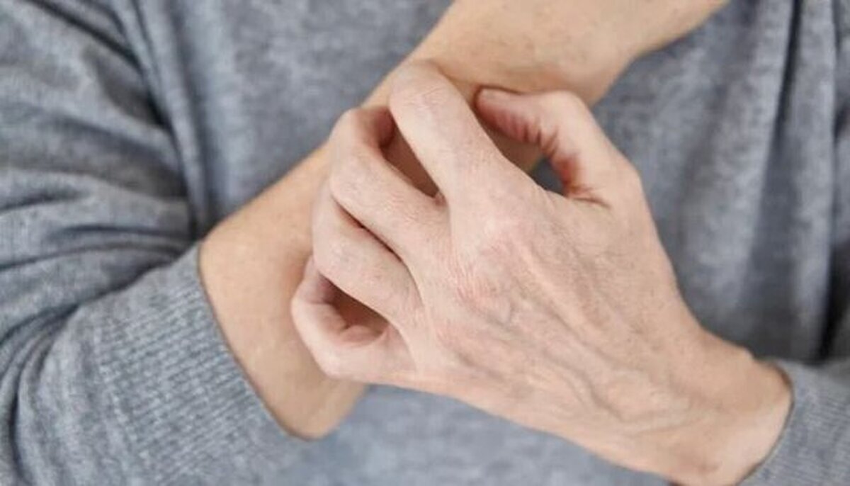 ۷ نشانه‌ پوستی که از بیماری جدی خبر می‌دهد