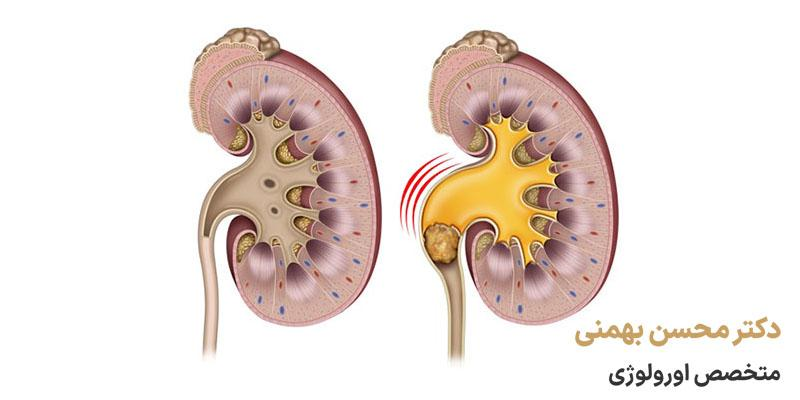 بهترین اورولوژیست در شهریار کیست و چه ویژگیهایی دارد؟ بهترین اورولوژیست در شهریار کیست و چه ویژگیهایی دارد؟