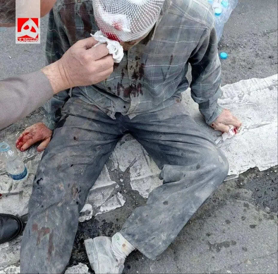 مجروحان حمله امروز صبح اسرائیل