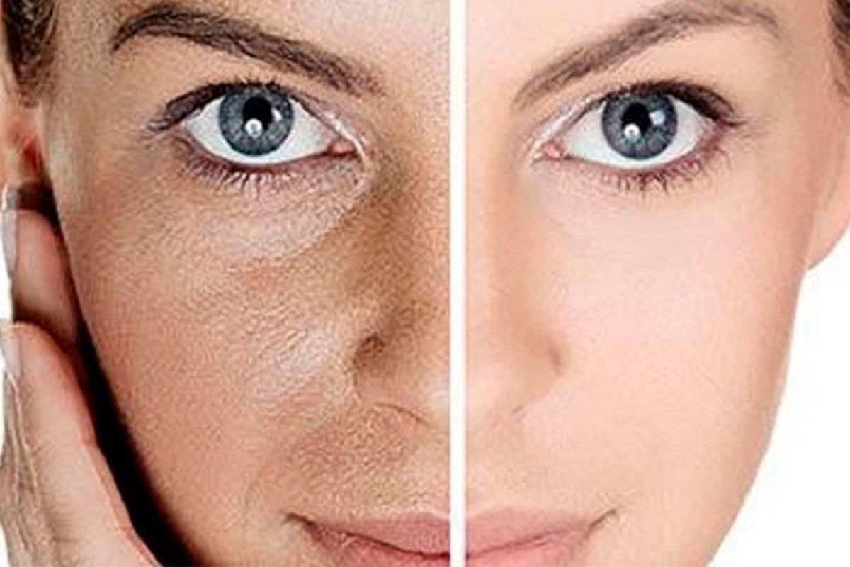 ماده غذایی که پوست صورت‌تان را جوان نگه می‌دارد
