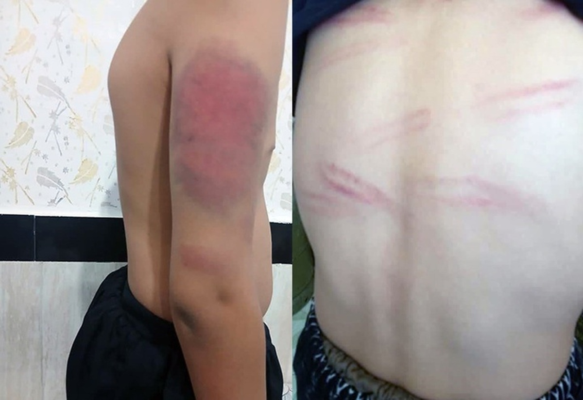 اخراج معلمی که دانش‌آموزان روستای کرجو را تنبیه بدنی کرده بود!