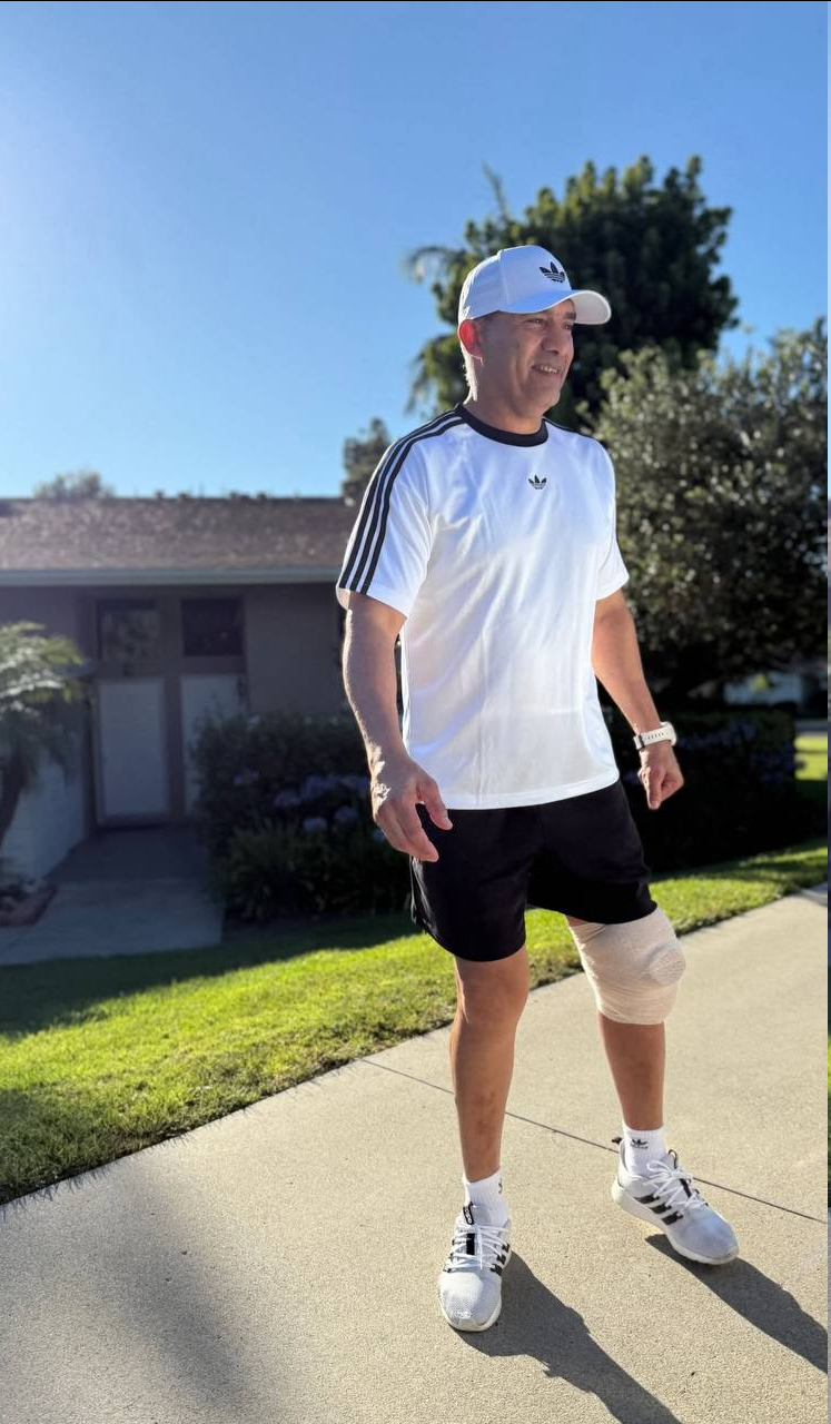 استایل جالب عابدزاده پس از عمل جراحی +عکس عابدزاده پس از عمل