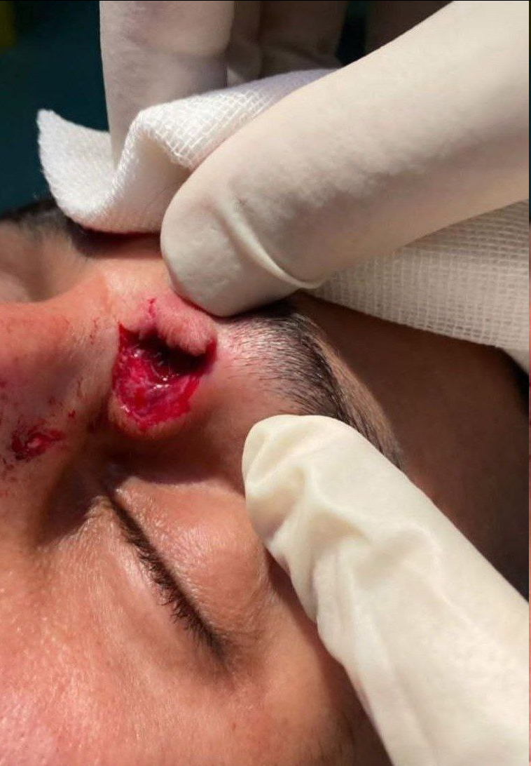 مصدومیت شدید علی علیپور در تمرین پرسپولیس