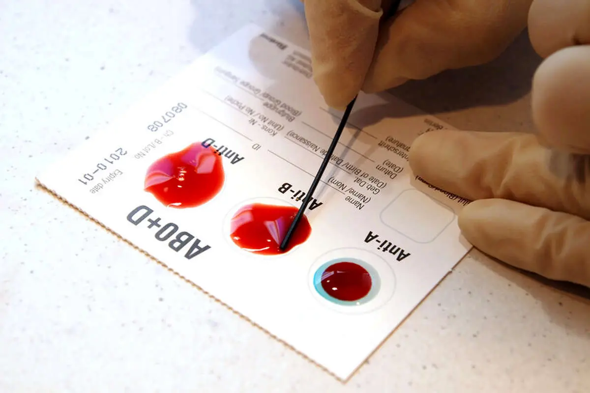 معمای خون شهرزاد؛ گروه خونی نایابی که پزشکان را غافلگیر کرد! گروه خونی