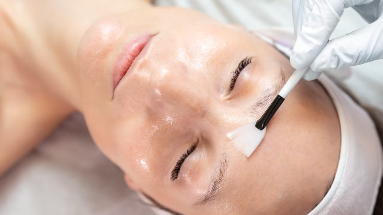 اسیدتراپی صورت؛ معجزهای برای پوستهای خسته و کدر اسیدتراپی صورت؛ معجزهای برای پوستهای خسته و کدر