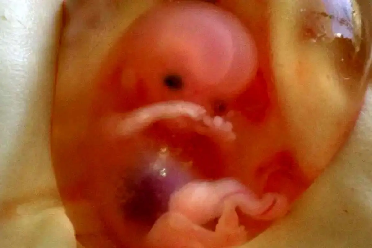 ماجرای گم‌شدن جنین‌ها در بیمارستان آبان