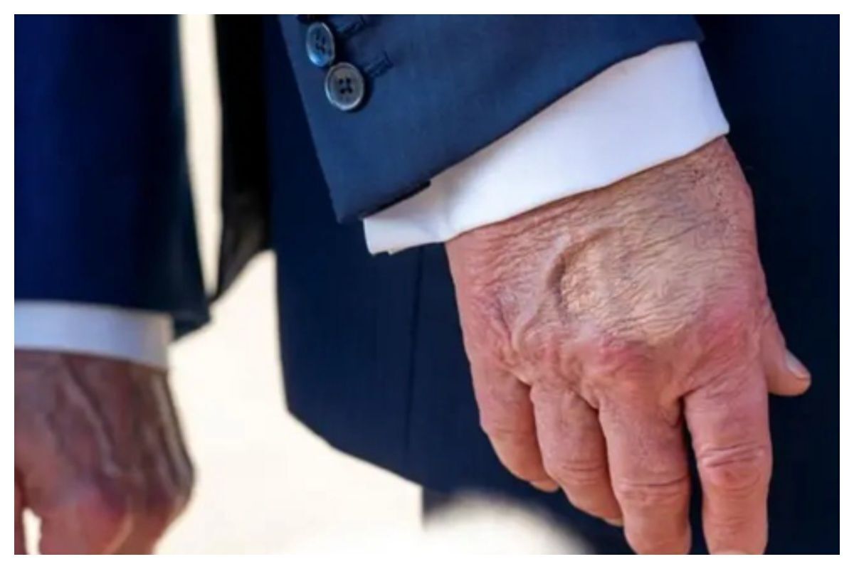 شباهت دستان ترامپ با دستان ملکهٔ انگلیس پیش از مرگش + عکس