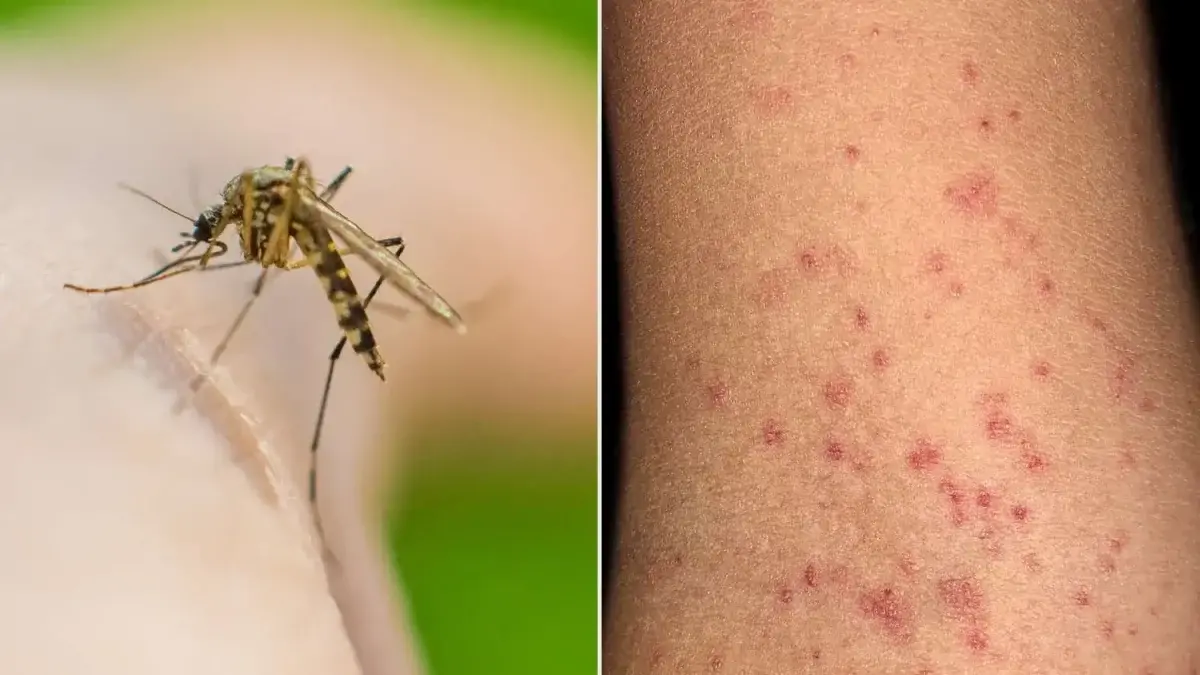 زنگ خطر شیوع تب دنگی در این منطقه به صدا در آمد