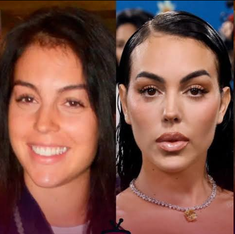 تحلیل پزشکان زیبایی از چهره جدید جورجینا رودریگز +عکس