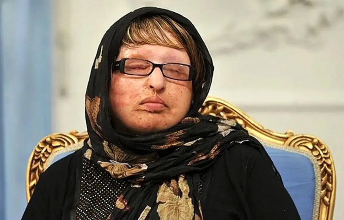 آمنه بهرامی آمنه بهرامی