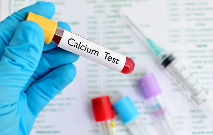 چگونه کلسیم خون را کاهش دهیم؟ کلسیم خون