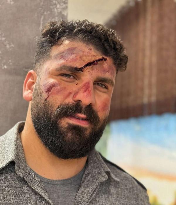 میلاد کرمی کیست؟| کوهنورد ایلامی و تکه کلام وضعتان چوونه معروفش بیوگرافی میلاد کرمی