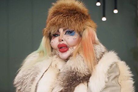 زن ایرانی با ۳۸۸ عمل زیبایی مدعی ثبت رکورد گینس شد