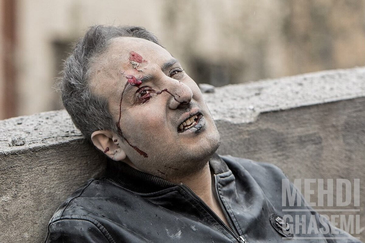 تصاویر دلخراش از حمله به مناطق مسکونی عباس آباد