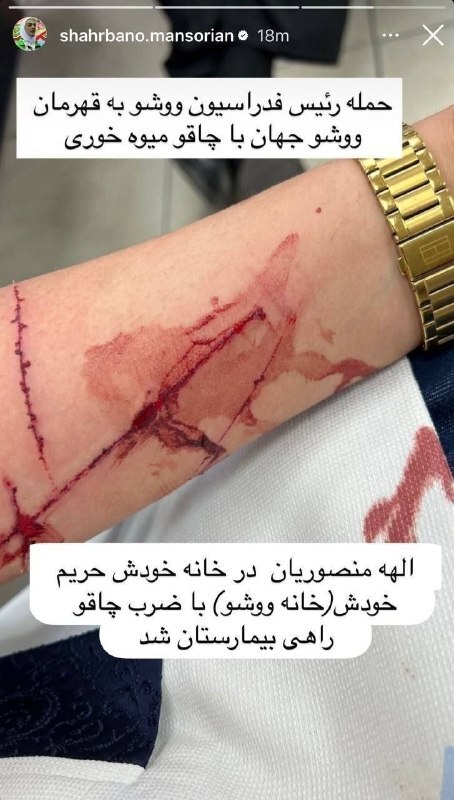 ادعای شهربانو منصوریان: رئیس فدراسیون با چاقو به الهه حمله کرد! +عکس ادعای شهربانو منصوریان: رئیس فدراسیون با چاقو به الهه حمله کرد! +عکس