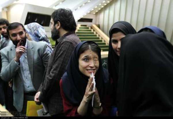 قربانیان اسید پاشی