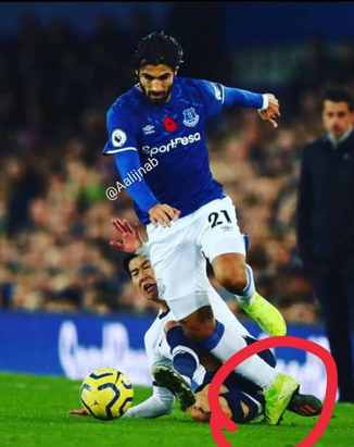 مصدومیت گومز