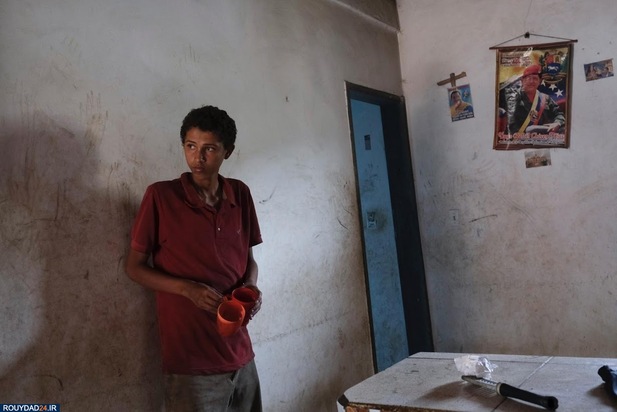 سوء تغذیه در کودکان ونزوئلا