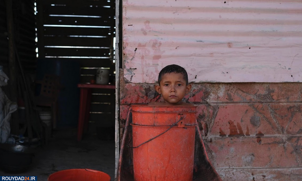 سوء تغذیه در کودکان ونزوئلا