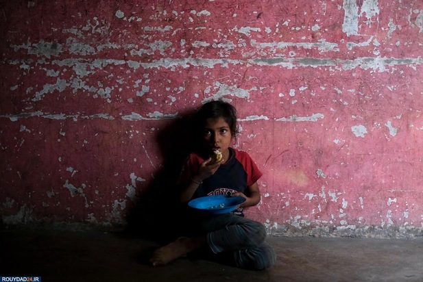 سوء تغذیه در کودکان ونزوئلا