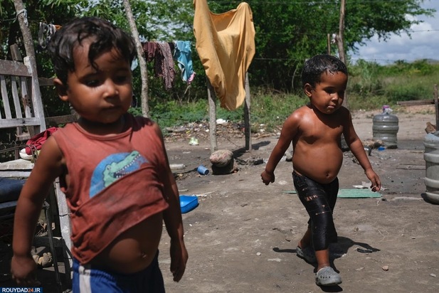 سوء تغذیه در کودکان ونزوئلا