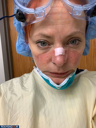 رد ماسک روی صورت پرستاران