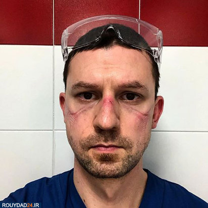 رد ماسک روی صورت پرستاران