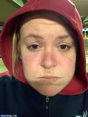 رد ماسک روی صورت پرستاران