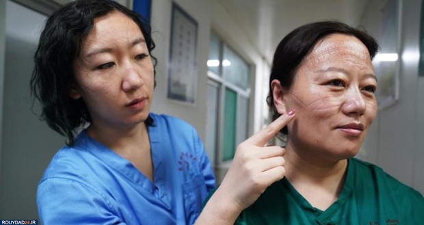 رد ماسک روی صورت پرستاران