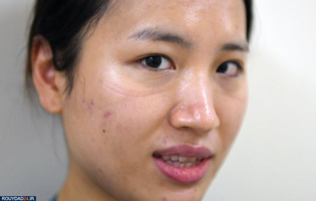 رد ماسک روی صورت پرستاران