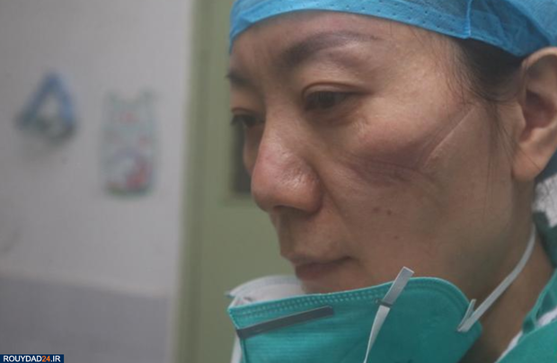 رد ماسک روی صورت پرستاران