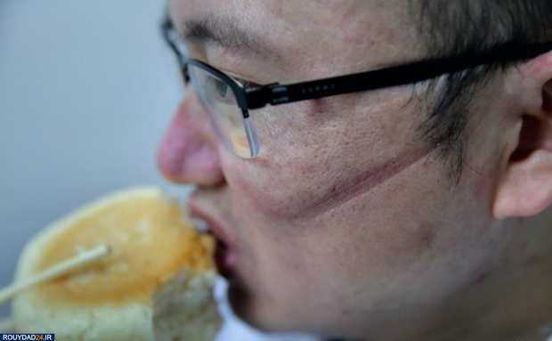 رد ماسک روی صورت پرستاران