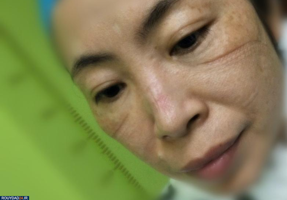 رد ماسک روی صورت پرستاران