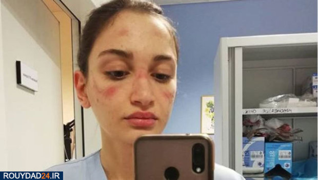 رد ماسک روی صورت پرستاران