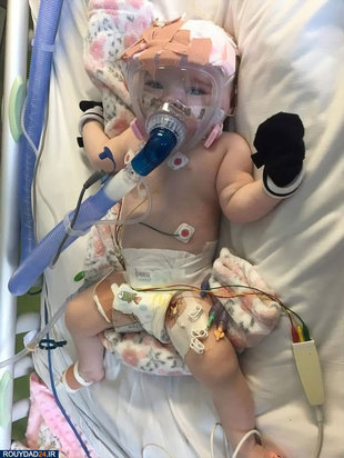 نوزاد شش ماهه کرونایی