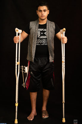 وضعیت تکان دهنده فلسطینی‌ها در پی حملات اسرائیل